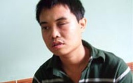 Một người dân bị công an bắn hỏng mắt